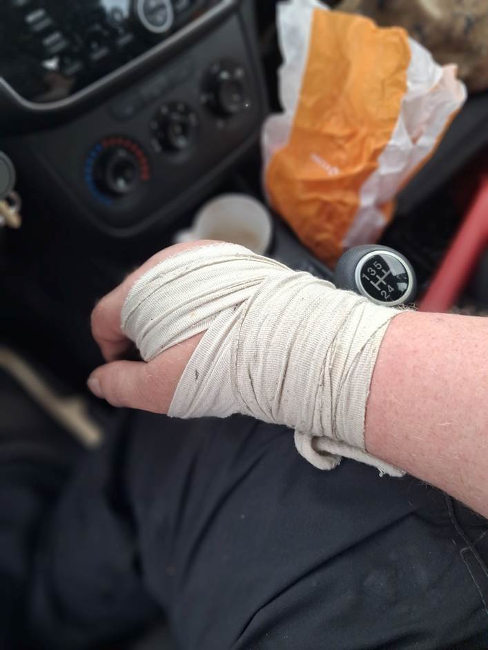 Et billede, der indeholder accessories/tilbehr, person, bandage, indendrs

AI-genereret indhold kan vre ukorrekt.